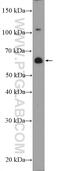 Zinc Finger Protein 397 antibody, 20799-1-AP, Proteintech Group, Western Blot image 