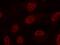 MAPK Activated Protein Kinase 2 antibody, P01193, Boster Biological Technology, Immunofluorescence image 