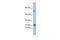 Phospholipase A2 Group IIC antibody, PA5-42005, Invitrogen Antibodies, Western Blot image 