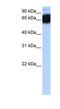 Zinc Finger Protein 90 antibody, NBP1-91427, Novus Biologicals, Western Blot image 