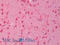 Troponin I3, Cardiac Type antibody, 43-244, ProSci, Enzyme Linked Immunosorbent Assay image 