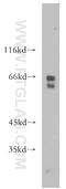 Retinoid isomerohydrolase antibody, 17939-1-AP, Proteintech Group, Western Blot image 
