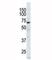 EPH Receptor A3 antibody, F50564-0.4ML, NSJ Bioreagents, Immunohistochemistry frozen image 