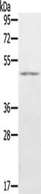 Lysine Demethylase 8 antibody, TA350106, Origene, Western Blot image 