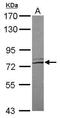 Leucine Rich Repeat Containing 4C antibody, GTX121508, GeneTex, Western Blot image 
