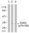 Cyclin Dependent Kinase 2 antibody, PA5-38128, Invitrogen Antibodies, Western Blot image 