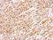 Fanconi anemia group J protein antibody, GTX100072, GeneTex, Immunohistochemistry paraffin image 