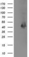 Microtubule Associated Protein RP/EB Family Member 2 antibody, NBP2-00714, Novus Biologicals, Western Blot image 