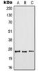 ADP Ribosylation Factor 6 antibody, orb213580, Biorbyt, Western Blot image 