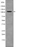 EPH Receptor A2 antibody, PA5-64784, Invitrogen Antibodies, Western Blot image 