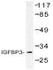 Insulin Like Growth Factor Binding Protein 3 antibody, AP20503PU-N, Origene, Western Blot image 