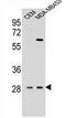 Interleukin 12B antibody, AP52183PU-N, Origene, Western Blot image 