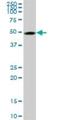 Tubulin Beta 2A Class IIa antibody, H00007280-M03, Novus Biologicals, Western Blot image 