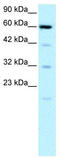 Solute Carrier Family 30 Member 9 antibody, TA329302, Origene, Western Blot image 