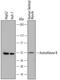 Arylsulfatase B antibody, MA5-24327, Invitrogen Antibodies, Western Blot image 