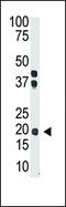 Interferon Lambda 3 antibody, 58-938, ProSci, Western Blot image 