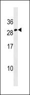 Erythropoietin antibody, 59-574, ProSci, Western Blot image 