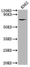 Hedgehog Interacting Protein antibody, CSB-PA850419LA01HU, Cusabio, Western Blot image 