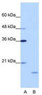Interferon-stimulated gene 20 kDa protein antibody, TA345796, Origene, Western Blot image 