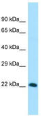 Vestigial Like Family Member 4 antibody, TA334088, Origene, Western Blot image 