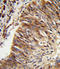 Aldehyde Dehydrogenase 3 Family Member B1 antibody, LS-C156263, Lifespan Biosciences, Immunohistochemistry paraffin image 