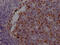 Aurora Kinase B antibody, CSB-RA230110A0HU, Cusabio, Immunohistochemistry paraffin image 