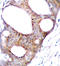 Glycogen Synthase Kinase 3 Alpha antibody, LS-C335794, Lifespan Biosciences, Immunohistochemistry paraffin image 