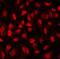 Friend leukemia integration 1 transcription factor antibody, A00399, Boster Biological Technology, Immunofluorescence image 