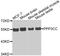 Protein Phosphatase 3 Catalytic Subunit Gamma antibody, MBS128931, MyBioSource, Western Blot image 