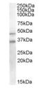 GULP PTB Domain Containing Engulfment Adaptor 1 antibody, orb18726, Biorbyt, Western Blot image 
