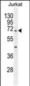 TBC1 Domain Family Member 3H antibody, PA5-71611, Invitrogen Antibodies, Western Blot image 