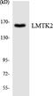 Lemur Tyrosine Kinase 2 antibody, EKC1868, Boster Biological Technology, Western Blot image 