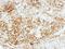 Vezatin, Adherens Junctions Transmembrane Protein antibody, GTX116241, GeneTex, Immunohistochemistry paraffin image 