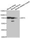 Keratin 5 antibody, abx002052, Abbexa, Western Blot image 