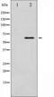 SMAD Family Member 1 antibody, TA325845, Origene, Western Blot image 
