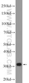 Capping Actin Protein Of Muscle Z-Line Subunit Beta antibody, 25043-1-AP, Proteintech Group, Western Blot image 