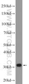 Capping Actin Protein Of Muscle Z-Line Subunit Beta antibody, 25043-1-AP, Proteintech Group, Western Blot image 