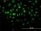 Histone Deacetylase 8 antibody, H00055869-M01, Novus Biologicals, Immunofluorescence image 