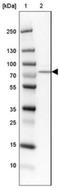 AceCS2 antibody, NBP2-30635, Novus Biologicals, Western Blot image 