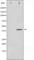 Eukaryotic Translation Initiation Factor 2 Subunit Alpha antibody, abx010700, Abbexa, Western Blot image 