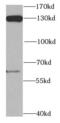 DNA Polymerase Delta 1, Catalytic Subunit antibody, FNab06606, FineTest, Western Blot image 