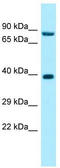 Ribonuclease P/MRP Subunit P30 antibody, TA338315, Origene, Western Blot image 