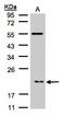 Actin Related Protein 2/3 Complex Subunit 3 antibody, NBP1-31422, Novus Biologicals, Western Blot image 