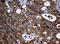 NME/NM23 Nucleoside Diphosphate Kinase 1 antibody, LS-C336328, Lifespan Biosciences, Immunohistochemistry paraffin image 