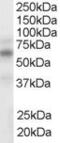 Nuclear Receptor Subfamily 1 Group H Member 3 antibody, MBS420979, MyBioSource, Western Blot image 