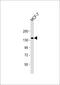 GRB10 Interacting GYF Protein 2 antibody, 61-231, ProSci, Western Blot image 