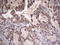 Galectin 3 antibody, LS-C798194, Lifespan Biosciences, Immunohistochemistry paraffin image 