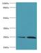 Thymidine Kinase 1 antibody, LS-C370443, Lifespan Biosciences, Western Blot image 