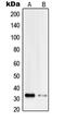 Phosphatidylinositol Transfer Protein Beta antibody, LS-C353369, Lifespan Biosciences, Western Blot image 