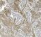 Integrin Subunit Beta 5 antibody, A04201-1, Boster Biological Technology, Immunohistochemistry paraffin image 